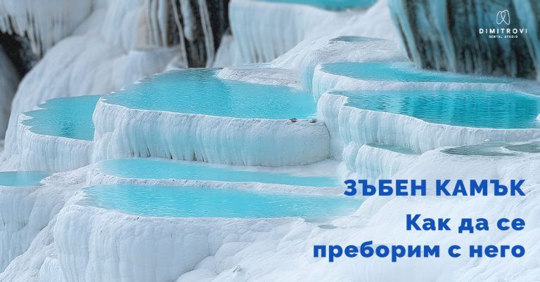Зъбен камък – как да се преборим с него