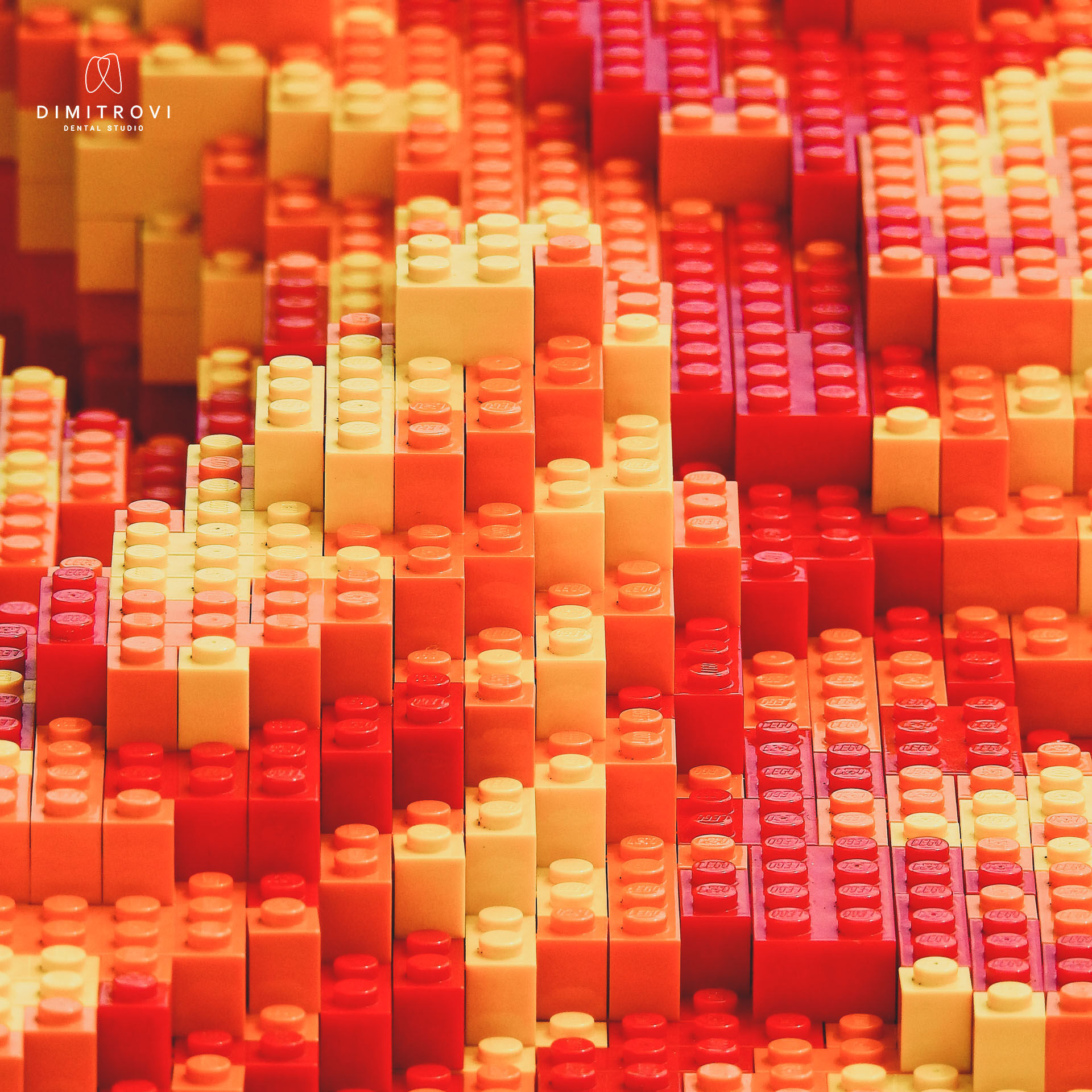 Представи си, че тези Lego блокчета са натрупан зъбен камък