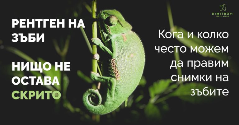 Рентген на зъби – кога и колко често е безопасно