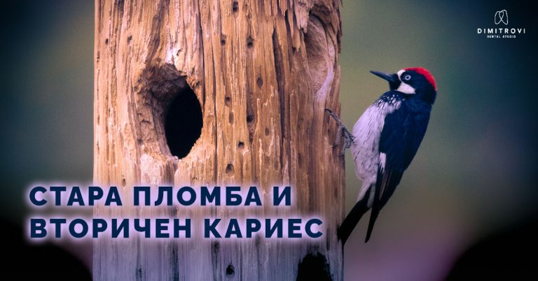СТАРА ПЛОМБА И ВТОРИЧЕН КАРИЕС